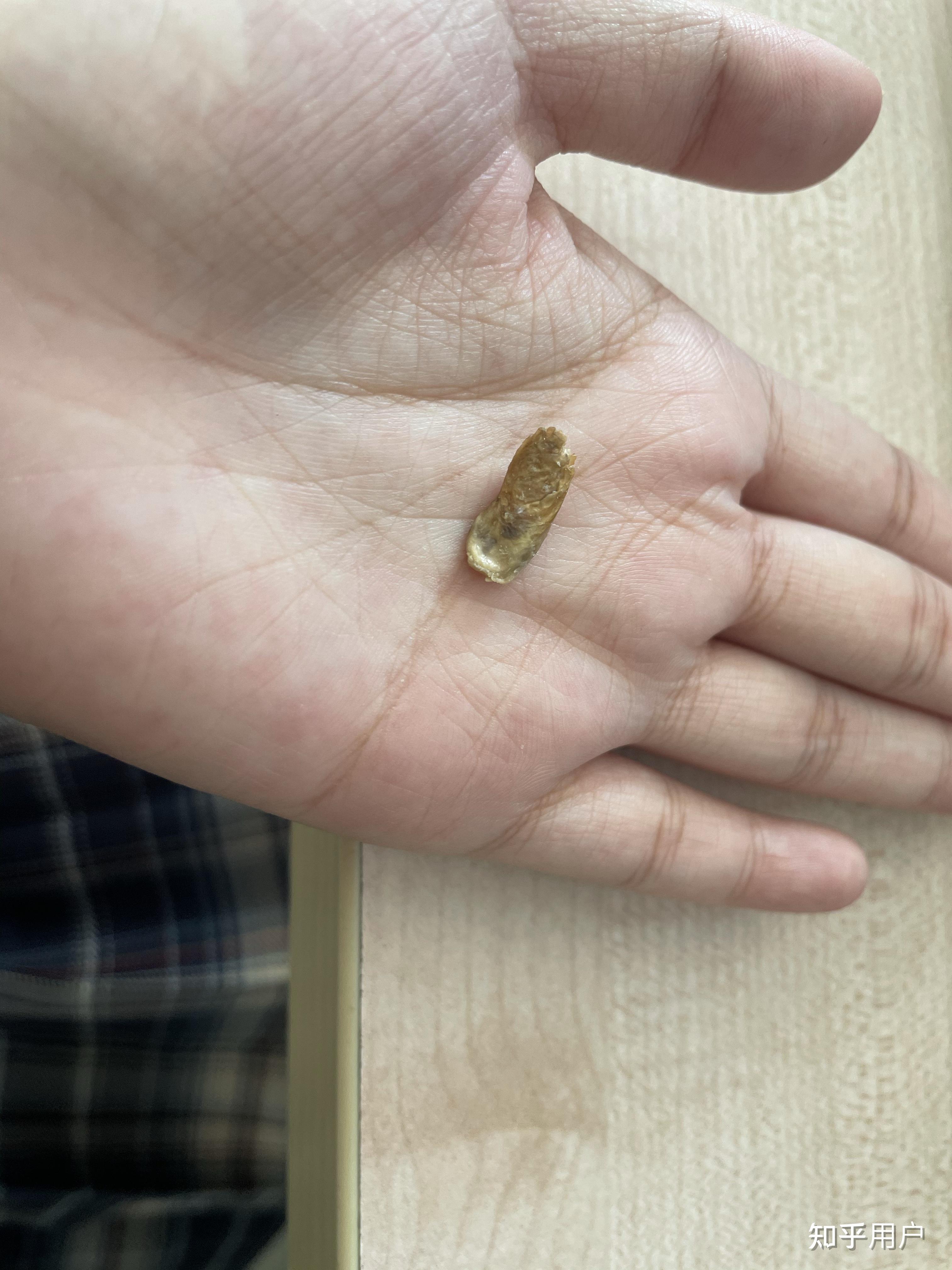 掏出一块超大耳屎,是种什么体验? - 知乎