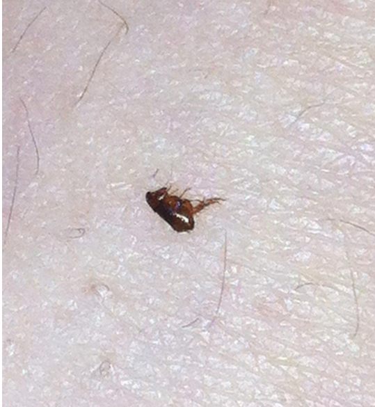 怎么辨别猫身上是否有跳蚤