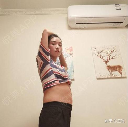 整容案例吸脂瘦腰腹让你的要对得起你漂亮的脸