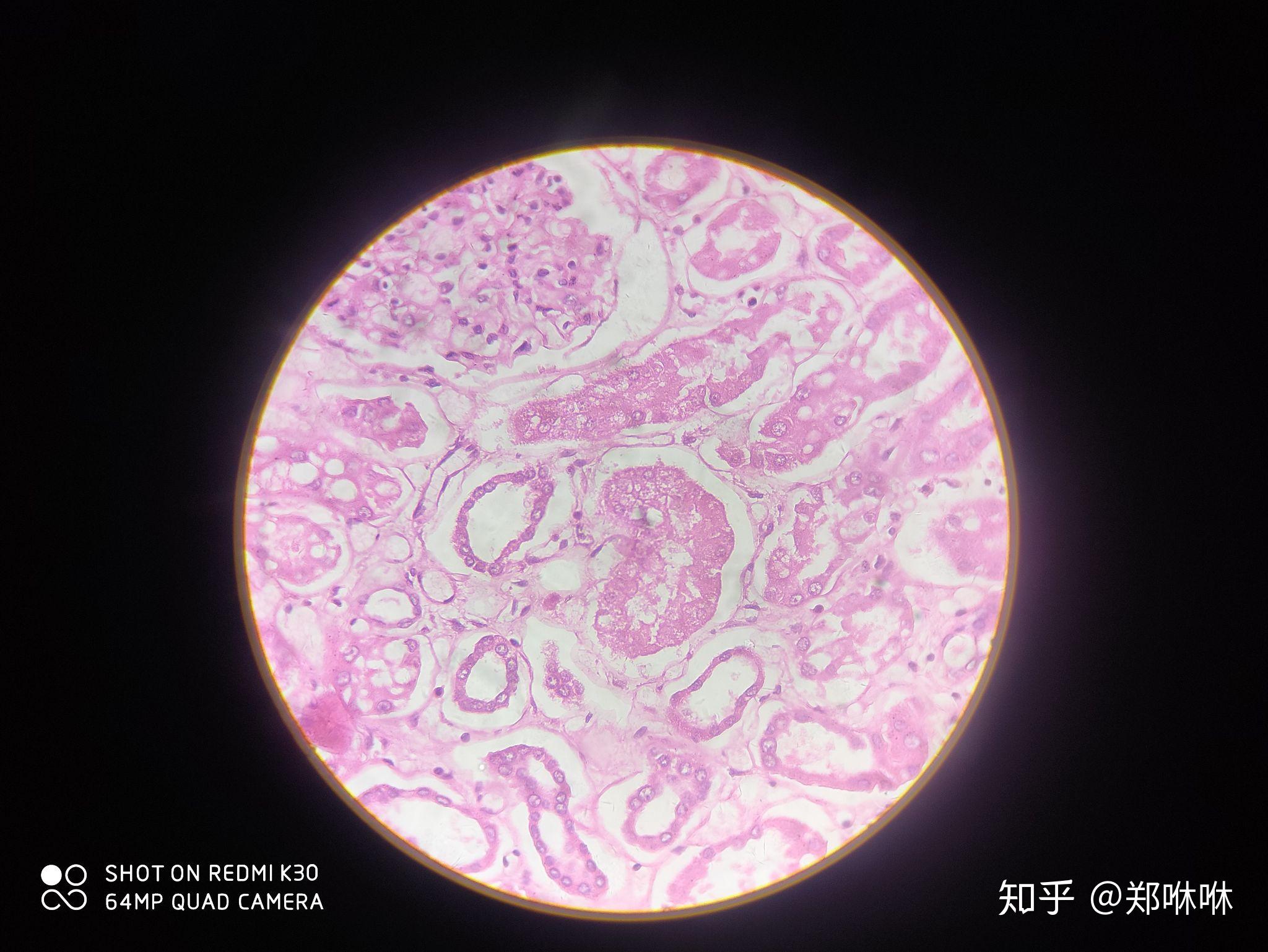 病理学红蓝铅笔图