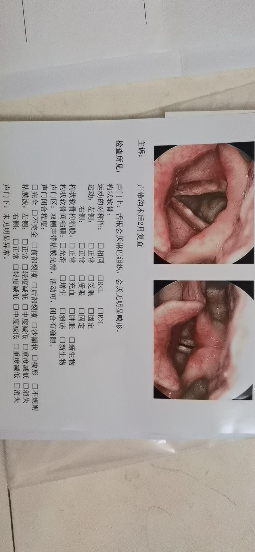 声带沟患者自述,希望有同种疾病的小伙伴能够有所帮助