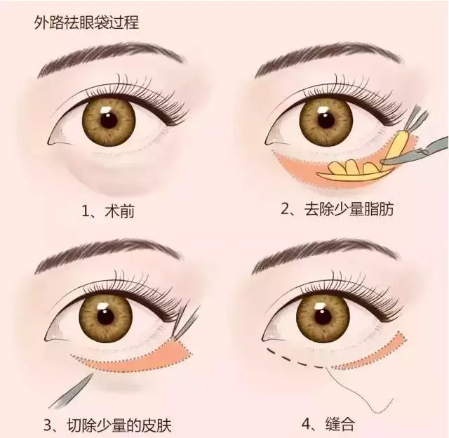 v2-a63f415d9bb7064b5bf6fa74f64d26b5_1440w.jpg?source=172ae18b