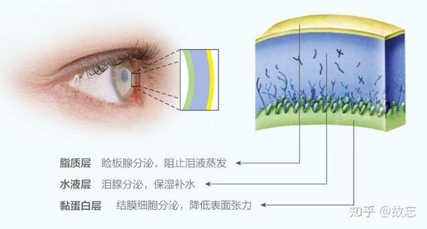 强脉冲光 Ipl 治疗干眼效果显著 Ipl强脉冲激光干眼症 丹若网