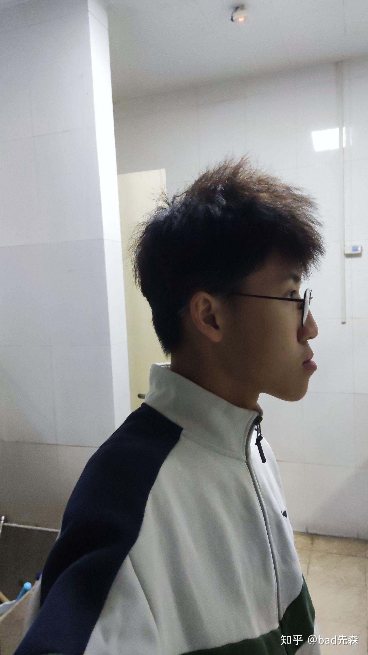 有没有地包天正颜还可以但侧颜巨丑的