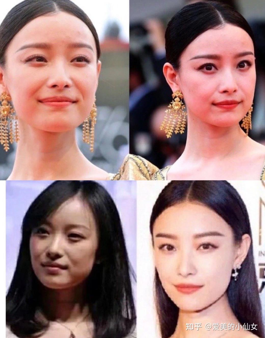 早期出道时倪妮的脸上是有赘肉感的,下颌线不清晰,法令纹也比较深