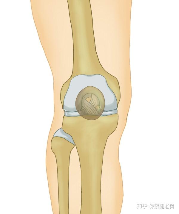 半月板缝合后 复查拍核磁为什么仍显示撕裂 做哪些康复训练呢 知乎