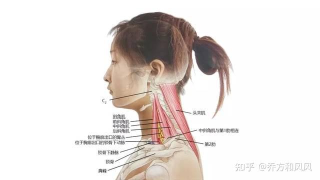 頸椎病僅是脖子疼按摩貼膏藥即可女白領未正確處理差點癱瘓