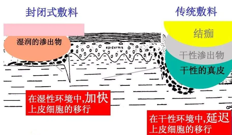 處理小白點小白泡別再用針這些方法才正確