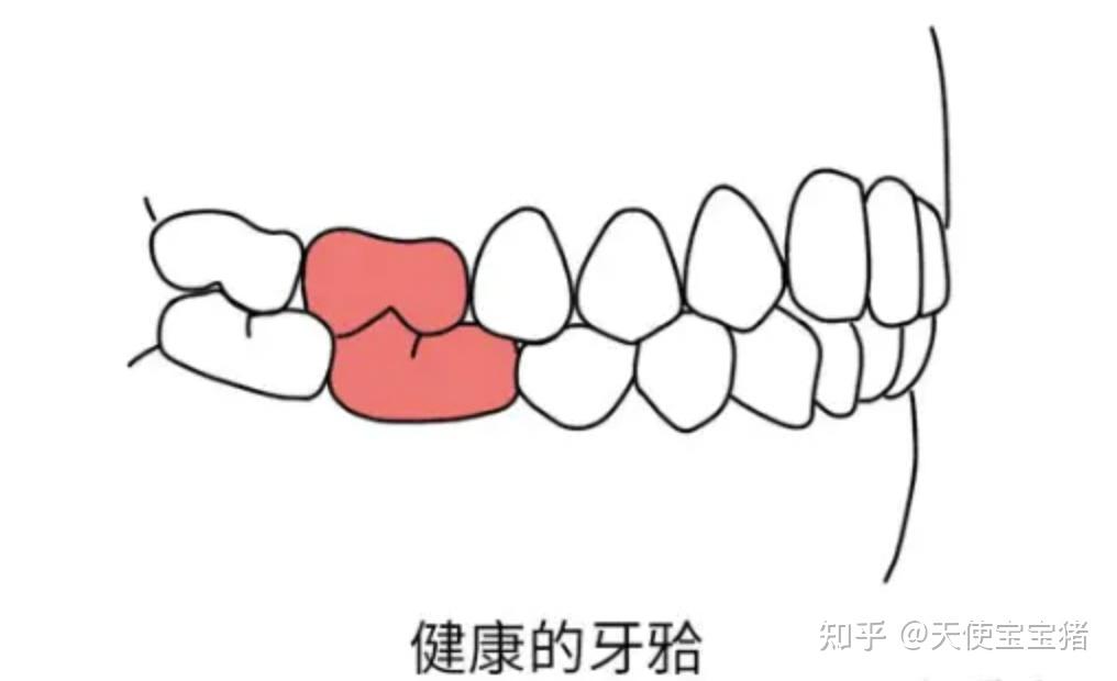 先来看看牙颌面,咱们健康的牙颌是这样的(没有错位哈,上下颌第一恒