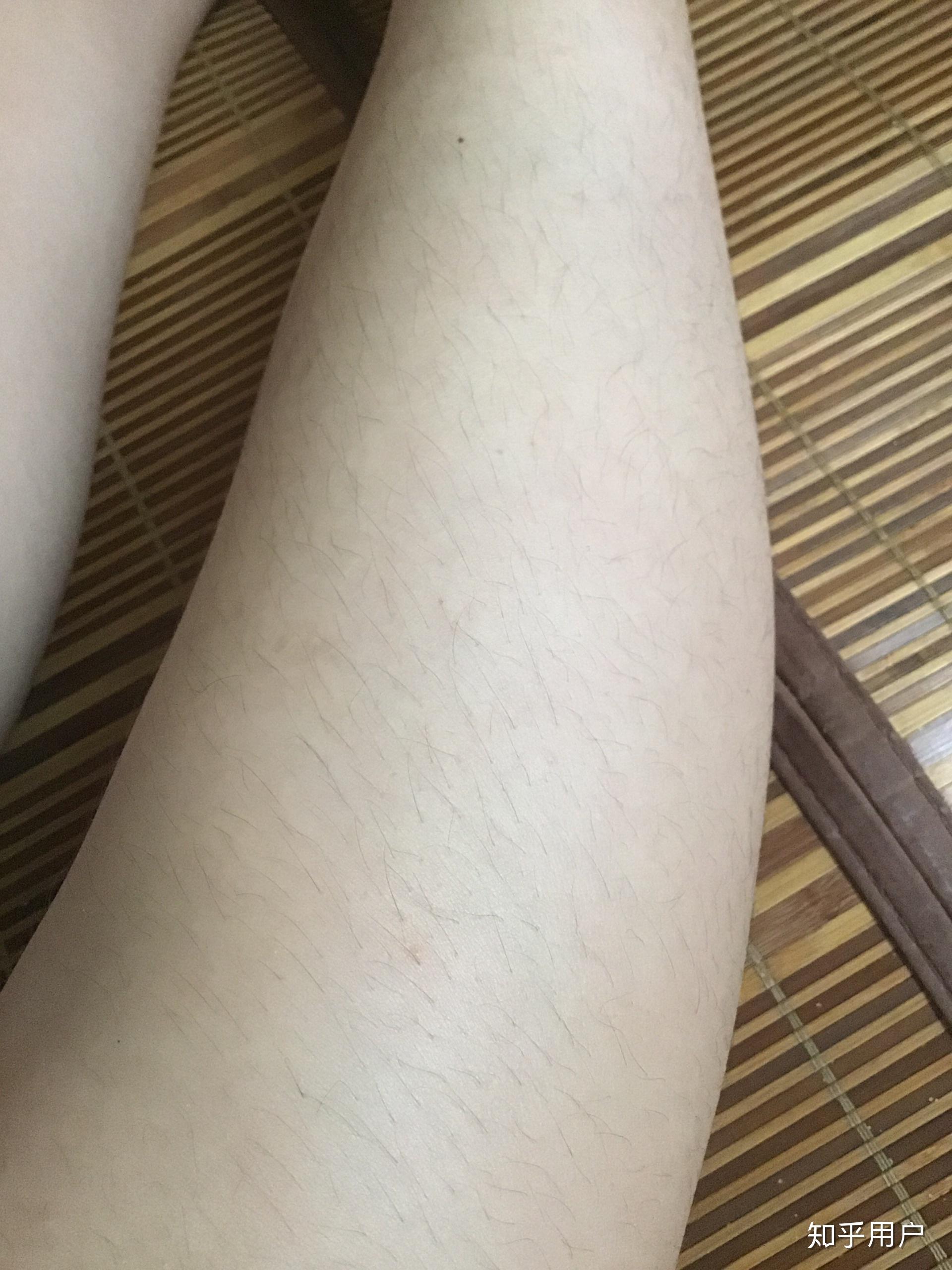 女生腿毛旺盛是怎样的人生体验