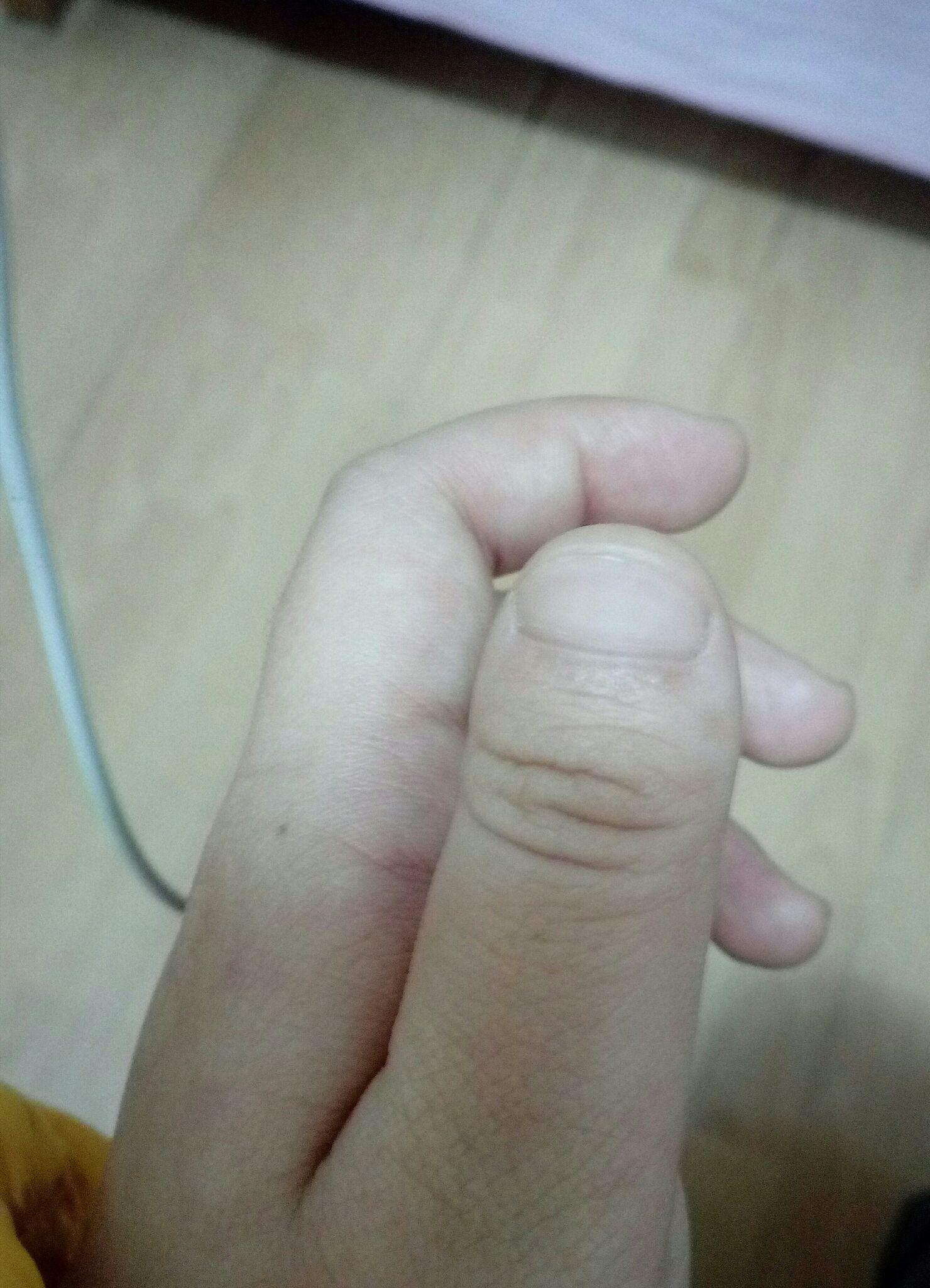 为什么我的大拇指又宽又短? - 知乎