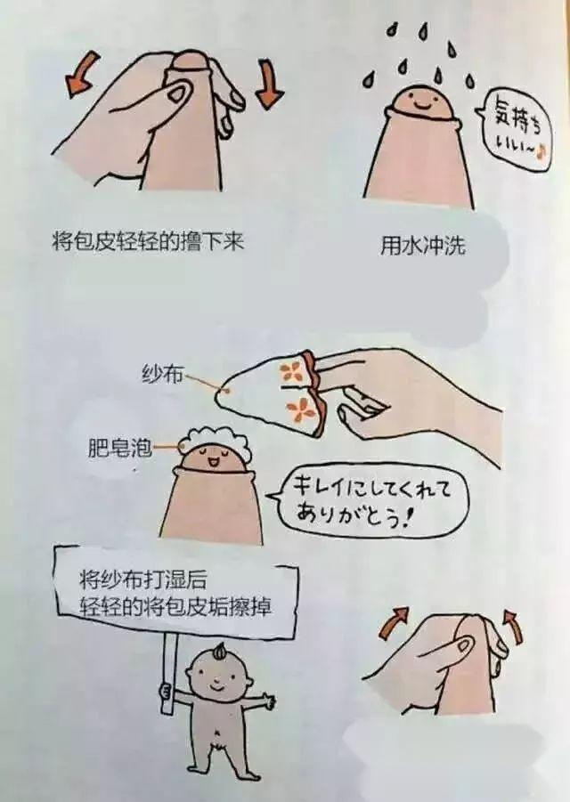 男童包茎粘连怎么办图片