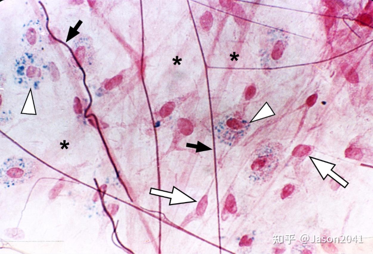 成纤维细胞的形态 - 知乎