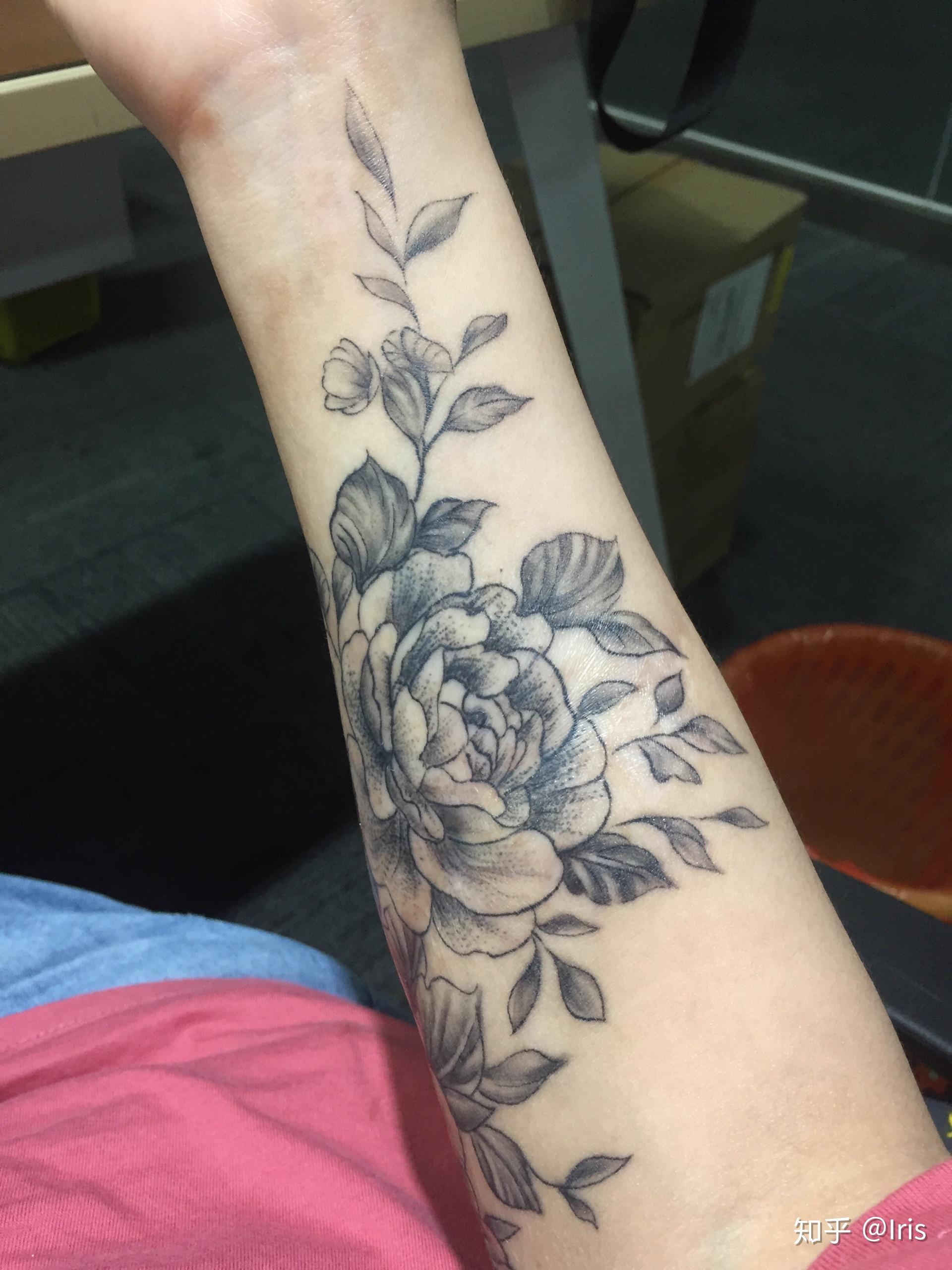 小臂内测有一块植皮了,有没有专业的人士回答我,可以在上面纹身吗?