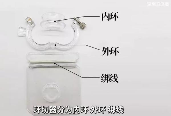真的能在家里自己割包皮吗？ - 知乎