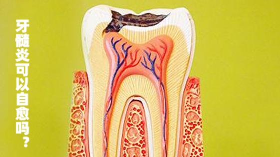牙髓炎可以自愈嗎?有哪些治療方法?