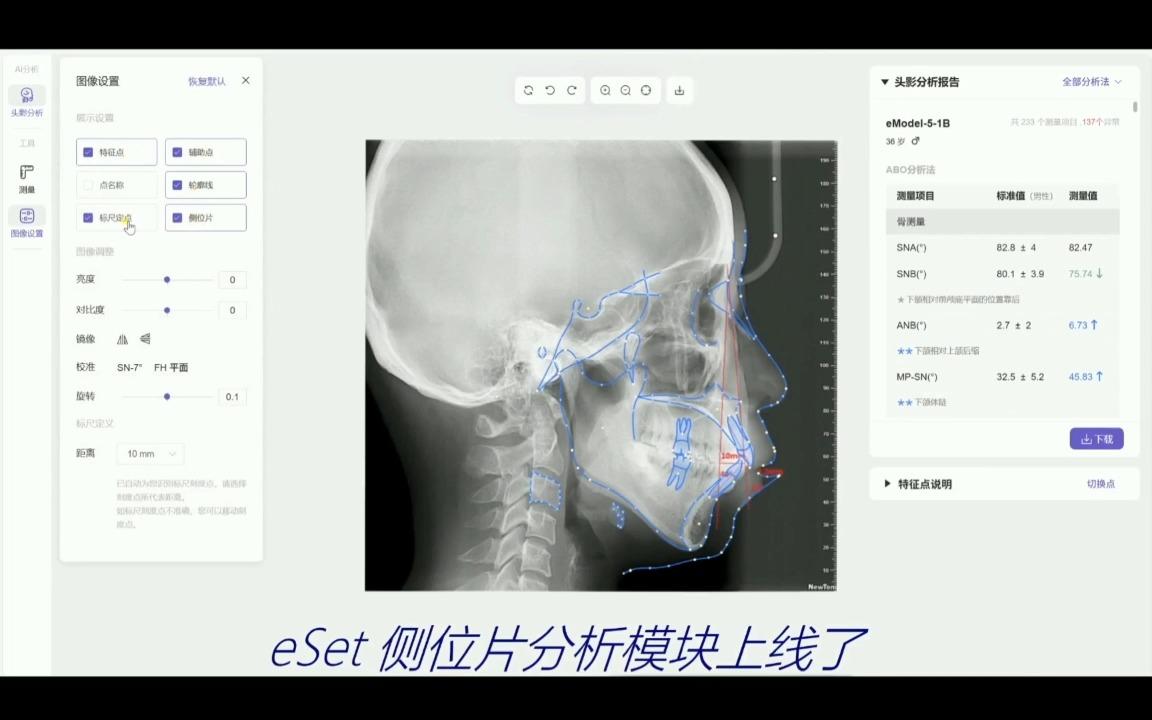 ai头影测量分析功能上线