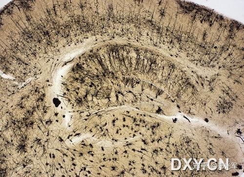 他也是我们初中科学(生物)课本上高尔基体的发现者.