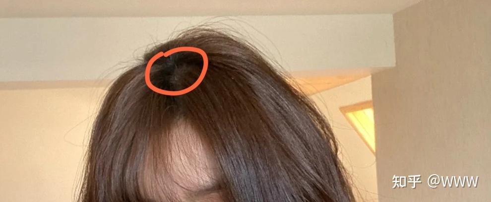 头发很贴很重很塌的人怎么让头顶看起来蓬松?