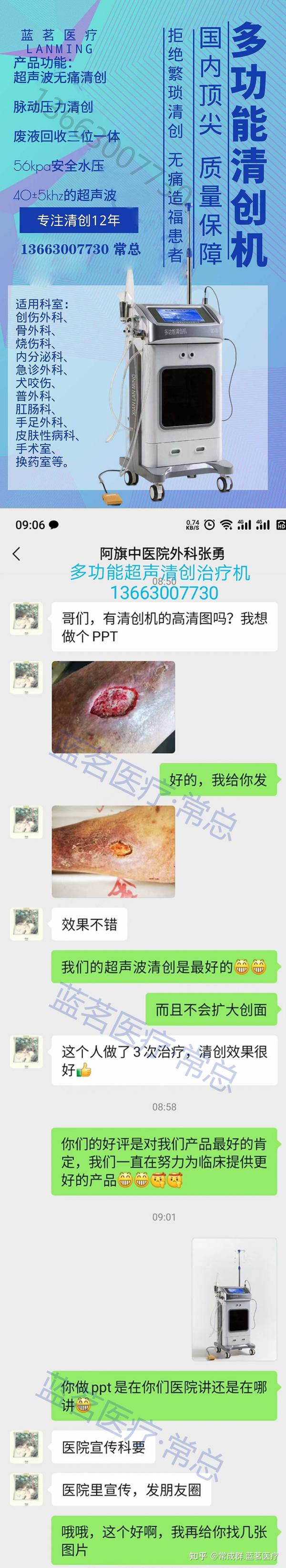 多功能清创机,清创设备,外伤清创仪器,超声波清创,创面清创仪器设备,烧伤清创仪,糖尿病手足清创仪,外科创面清理设备,清创机,超声清创仪,清理 ...