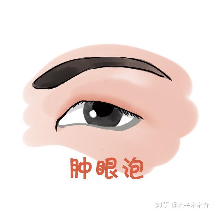 如何让眼睛快速恢复正常 v2-a825139323265fc443b1fd75b0a6fc44_r.jpg