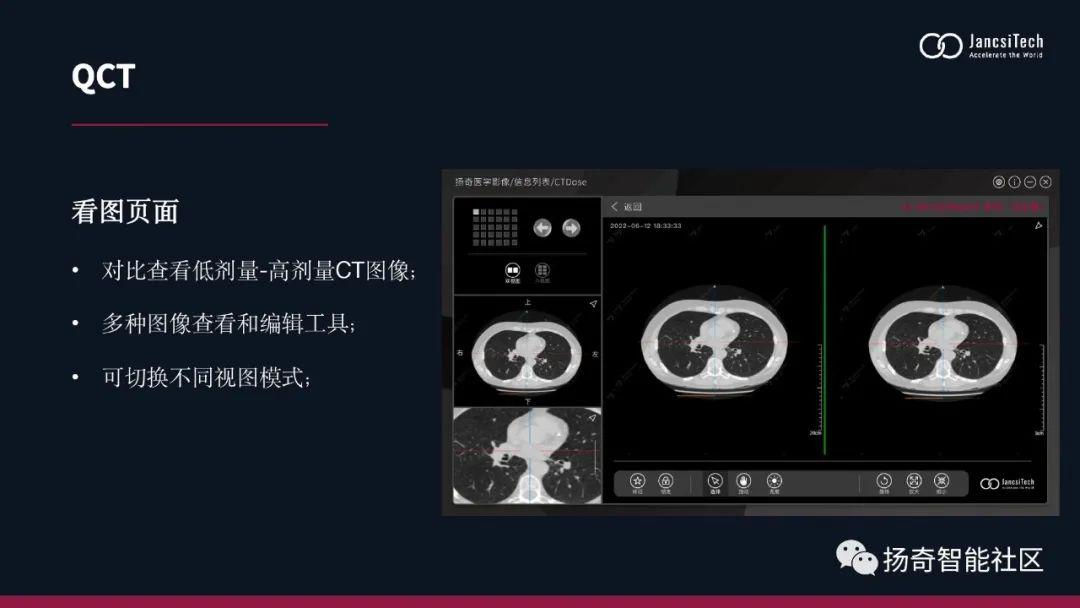 扬奇智能社区｜医学影像增强算法 - 知乎