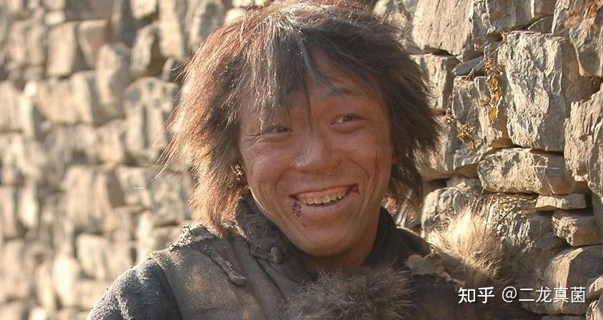 因为长的丑自卑社恐走在大街人多的地方都感觉都在嘲笑自己我该怎么办