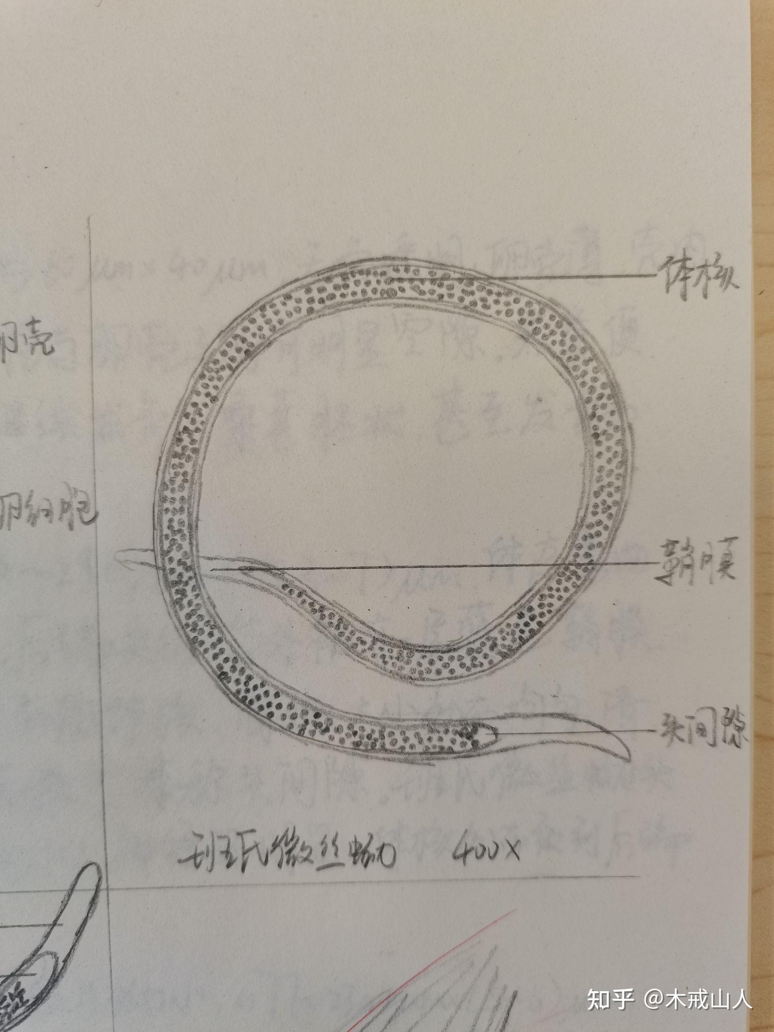 钩虫图片手绘图图片