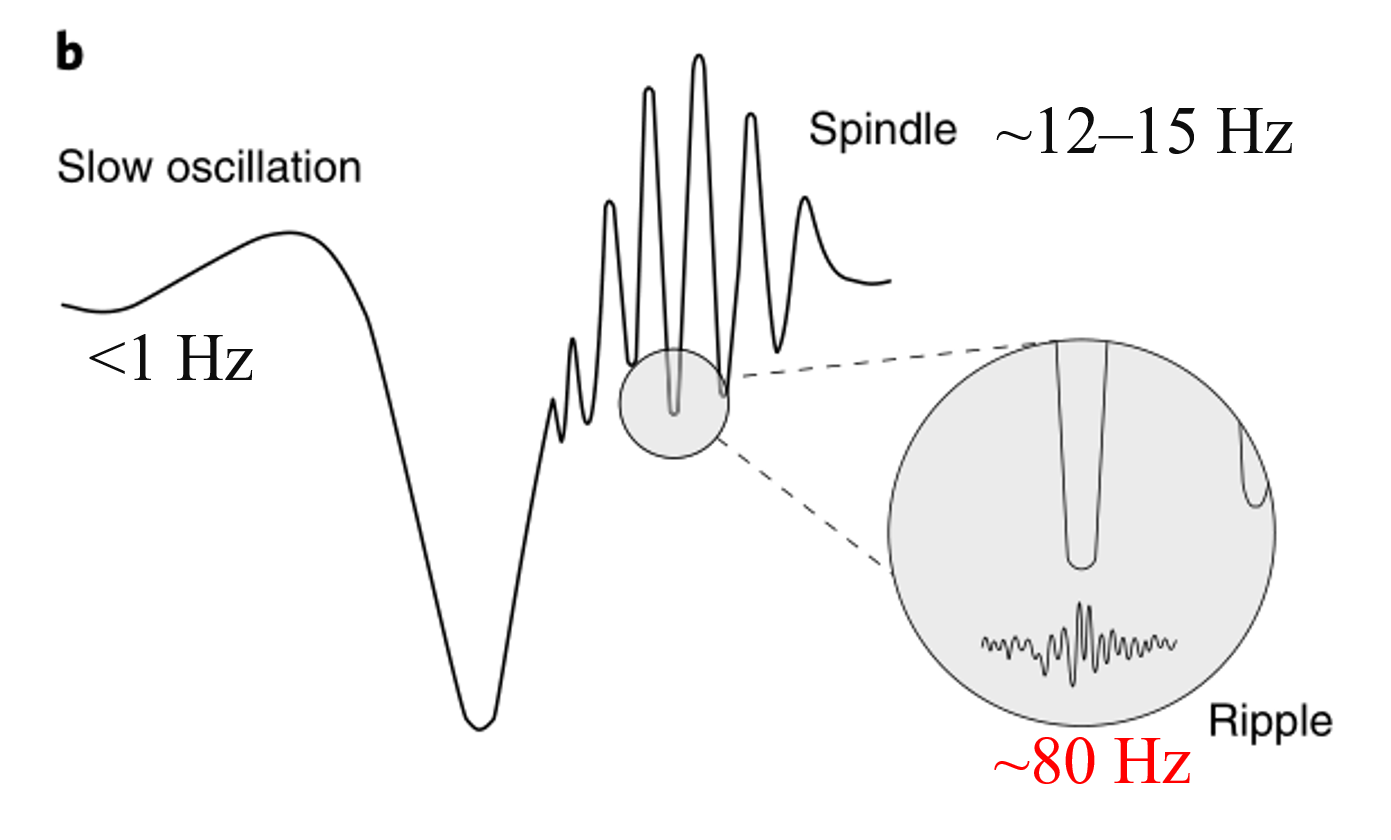 人类在睡眠状态下的慢波常常伴随着12到15hz的纺锤波(spindle)出现
