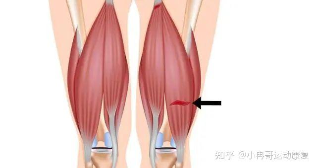 bw必威西汉姆联官网-埃斯特旺轻伤无碍世界杯经巴西队医远程诊断确认为轻微拉伤稳进26人名单
