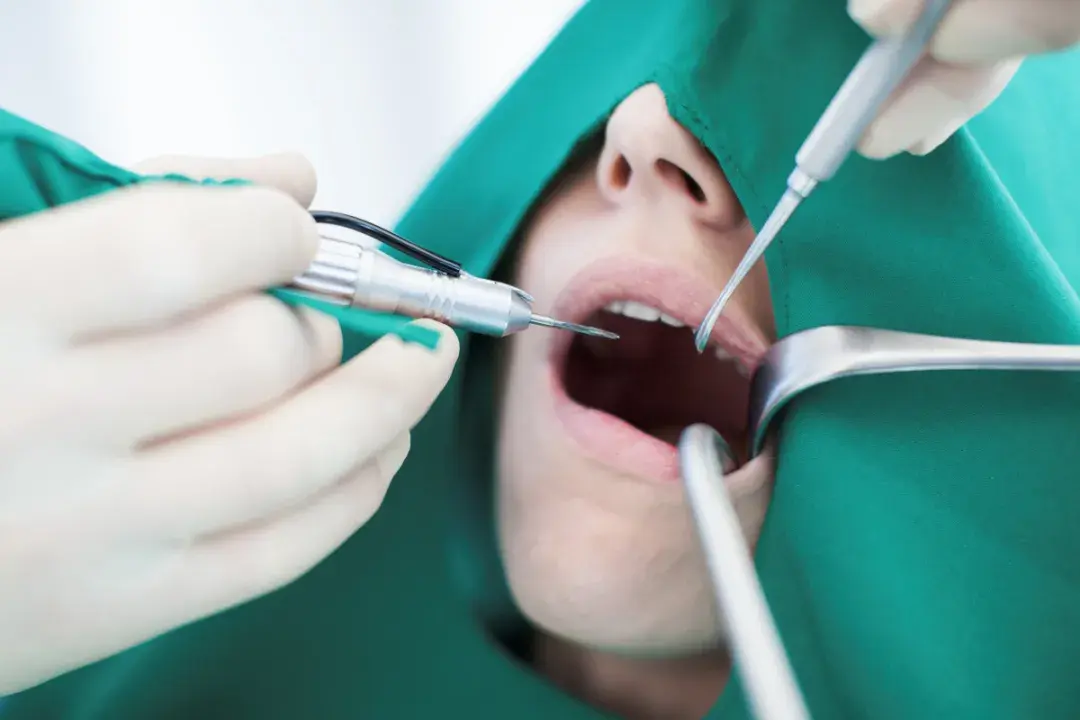 种植牙疼不疼过来人说出真相