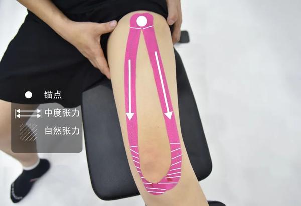 《肌贴使用指南》,正在跑步的你一定需要