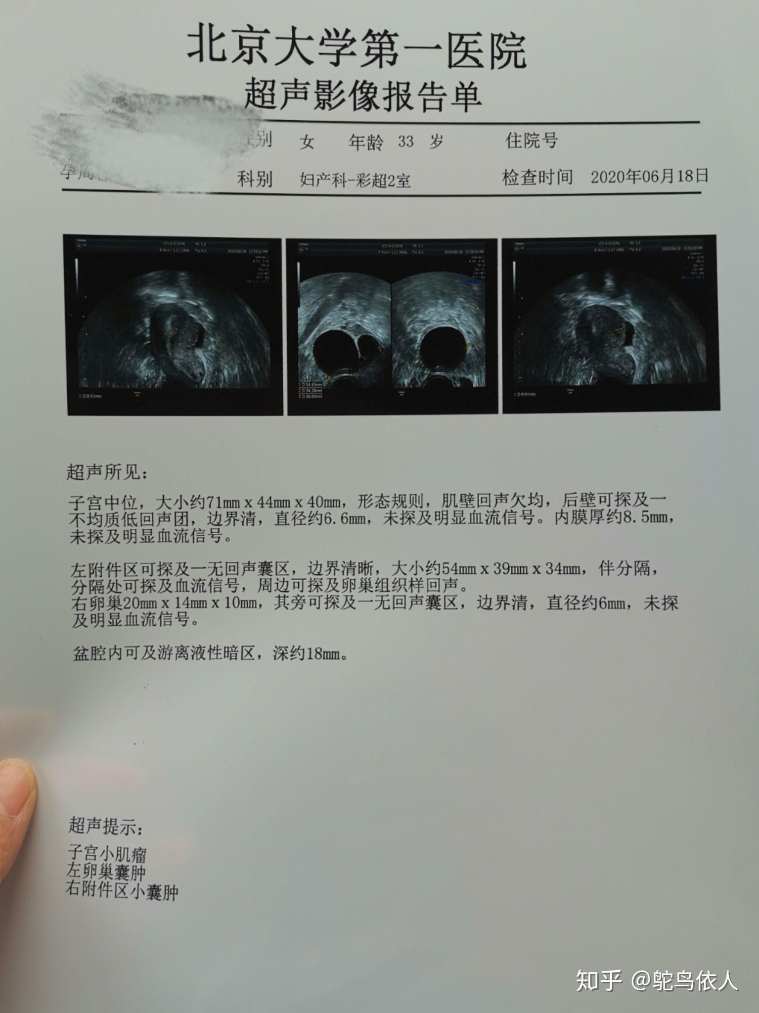 囊肿化验单图片图片