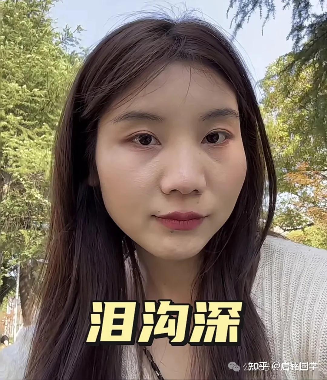 面相之泪目深 - 知乎