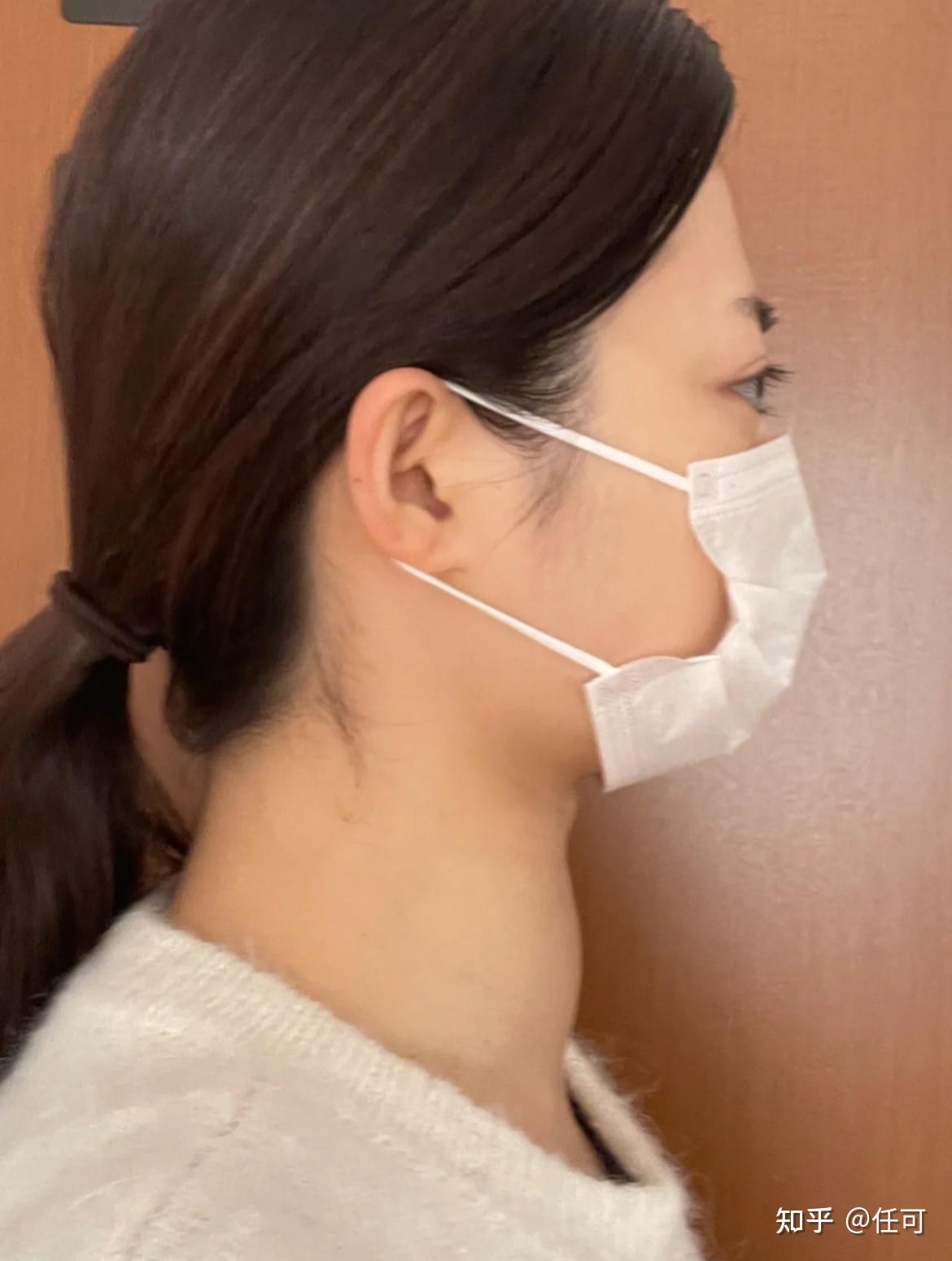 脖子肿胀烦躁失眠看中医如何帮您解决