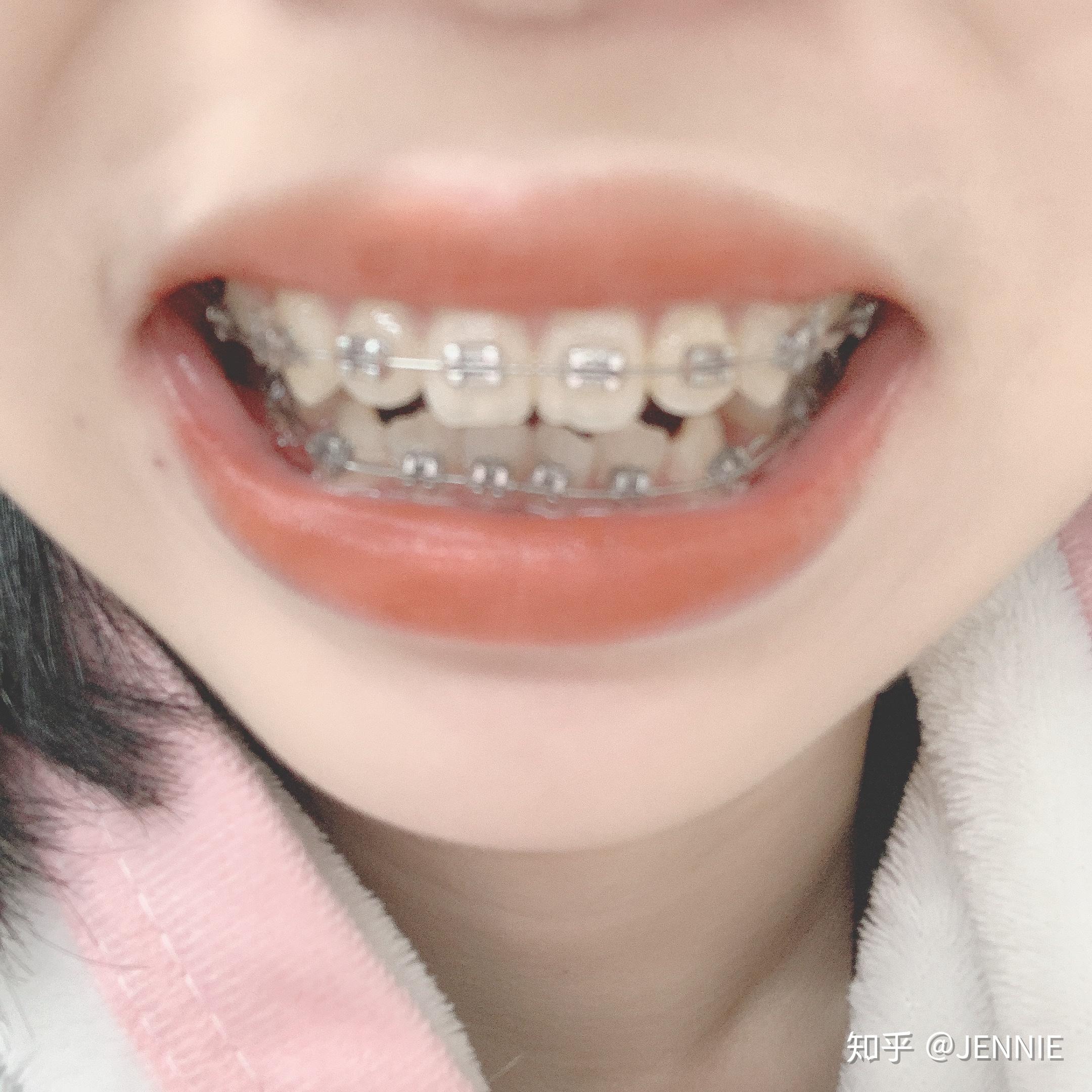 v2-a8bbc91737ff6e8fc1cabbece0b8013c_r.jpg