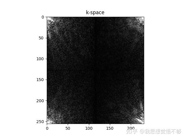 mri-python