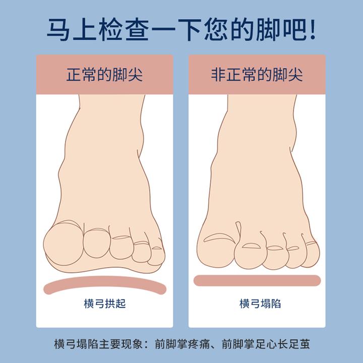 横弓塌陷和扁平足分别是什么?