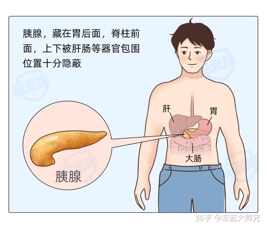 年轻人会得胰腺癌吗