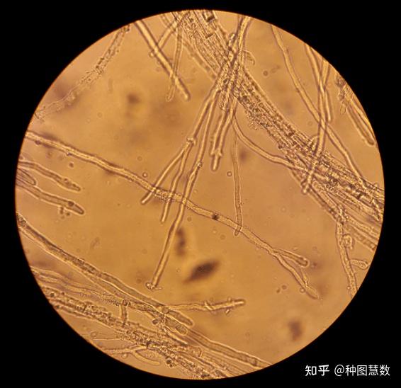 菌丝是什么？