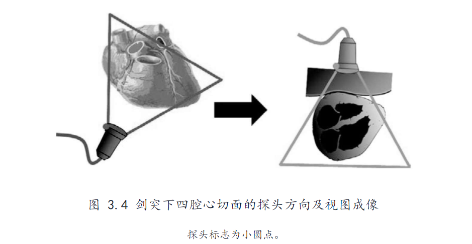 扇形超声探头图片