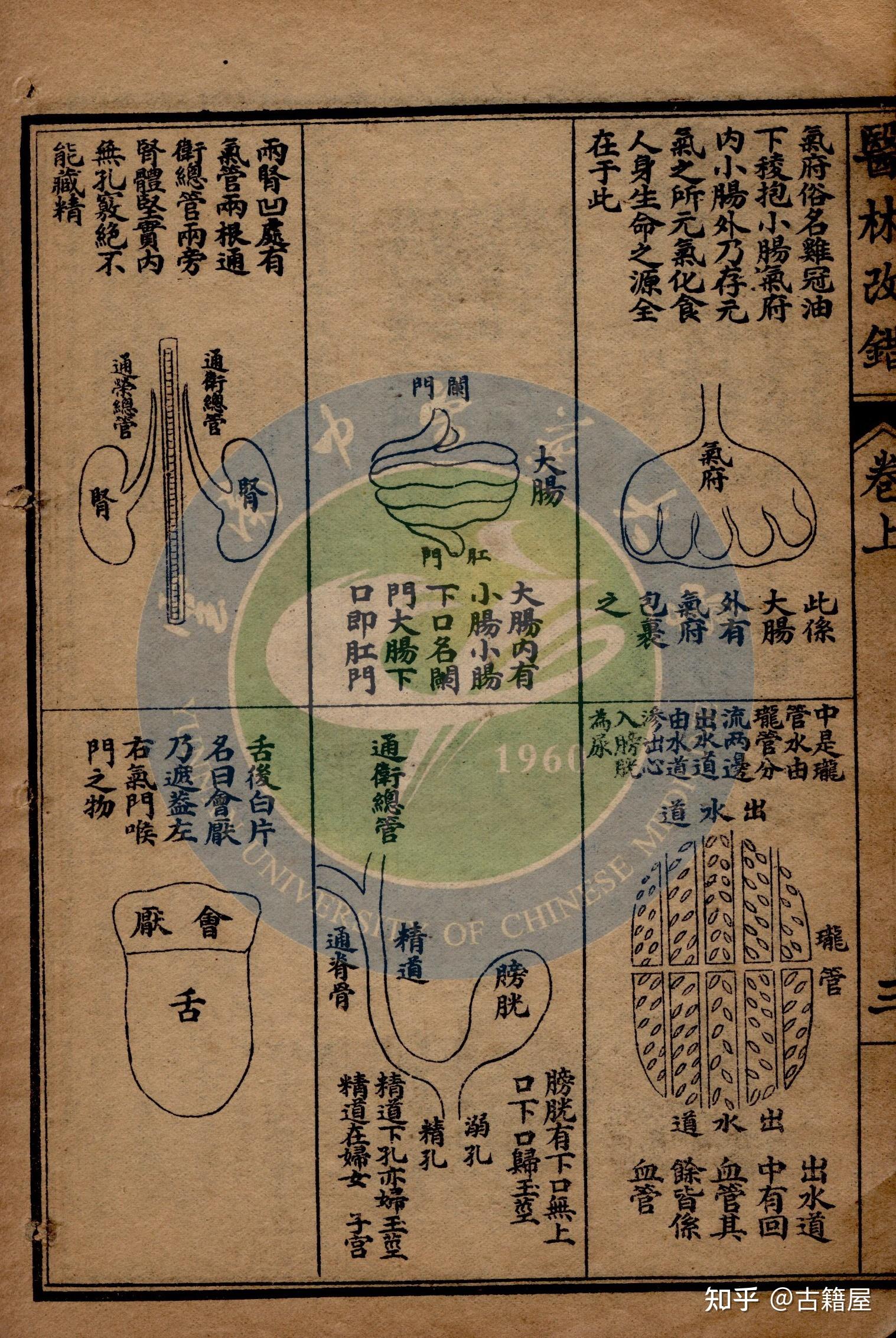 中医古籍《医林改错》清咸丰三年石印本 - 知乎