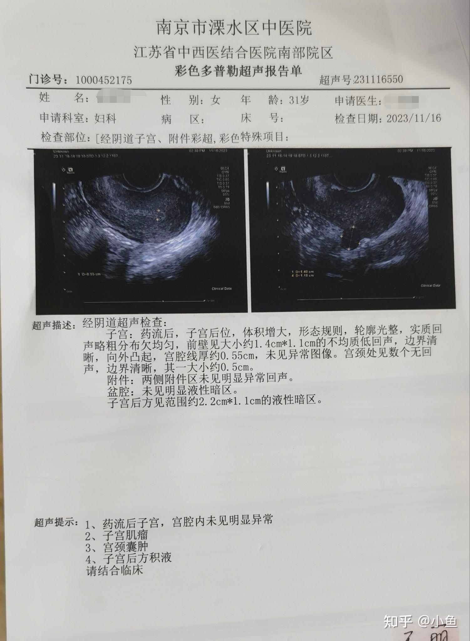 药流成功的图片图片