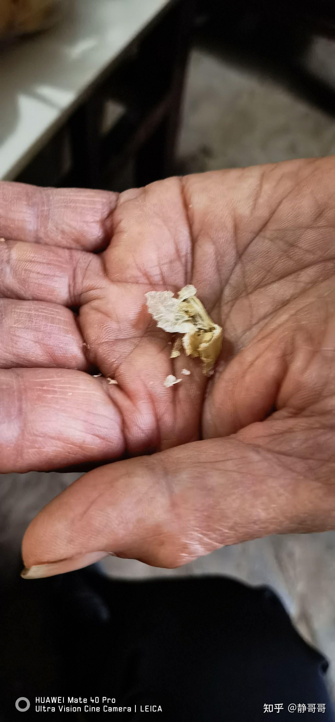 耳屎最大能有多大