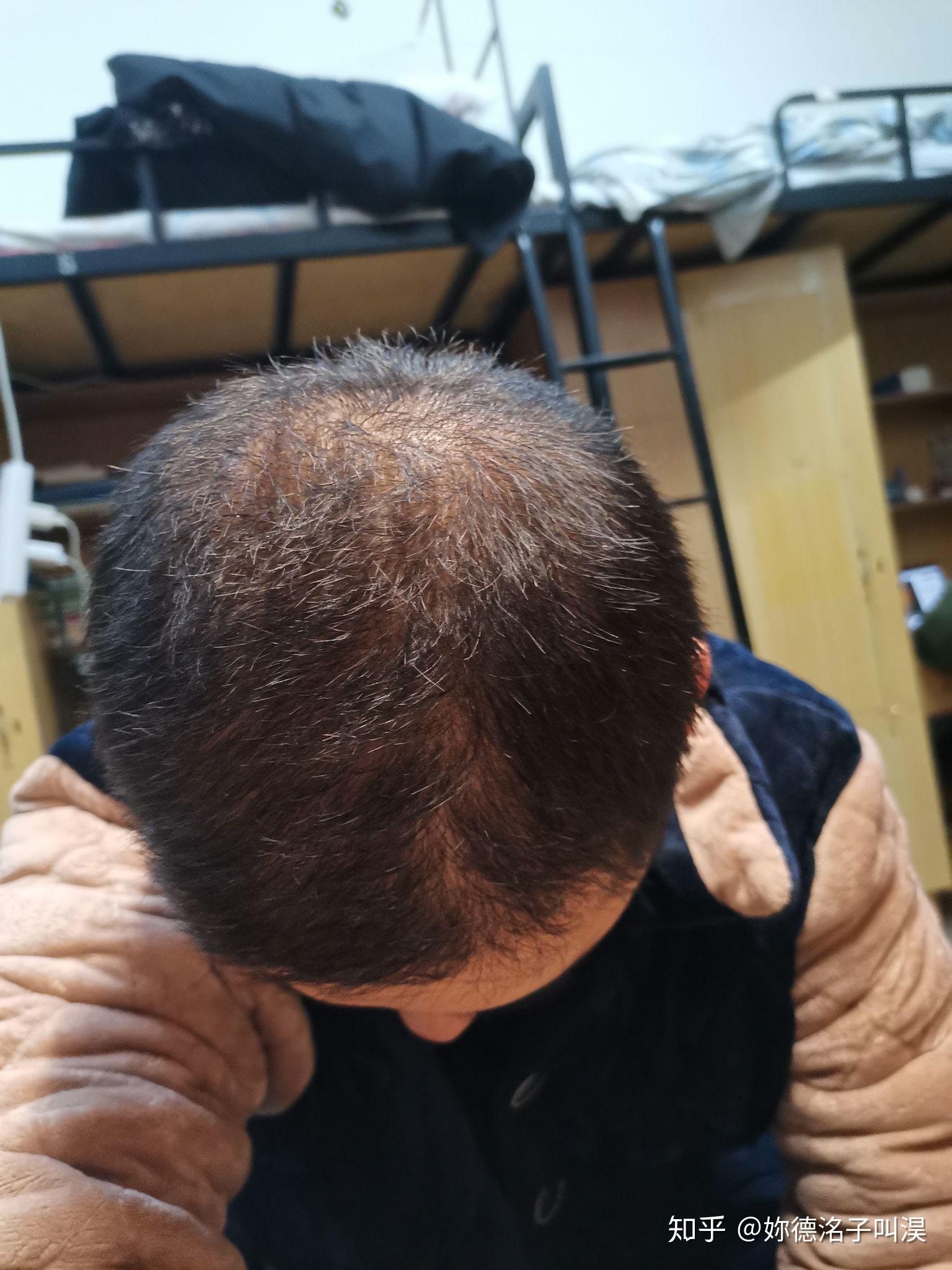 关注问题 67 写回答 登录/注册 发型 发型设计师 男士发型 头发