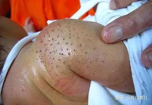 首先我们要来了解一下胎脂这个东西.