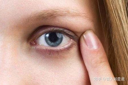 首大王宇 缓解眼部浮肿先从改掉坏习惯开始 知乎