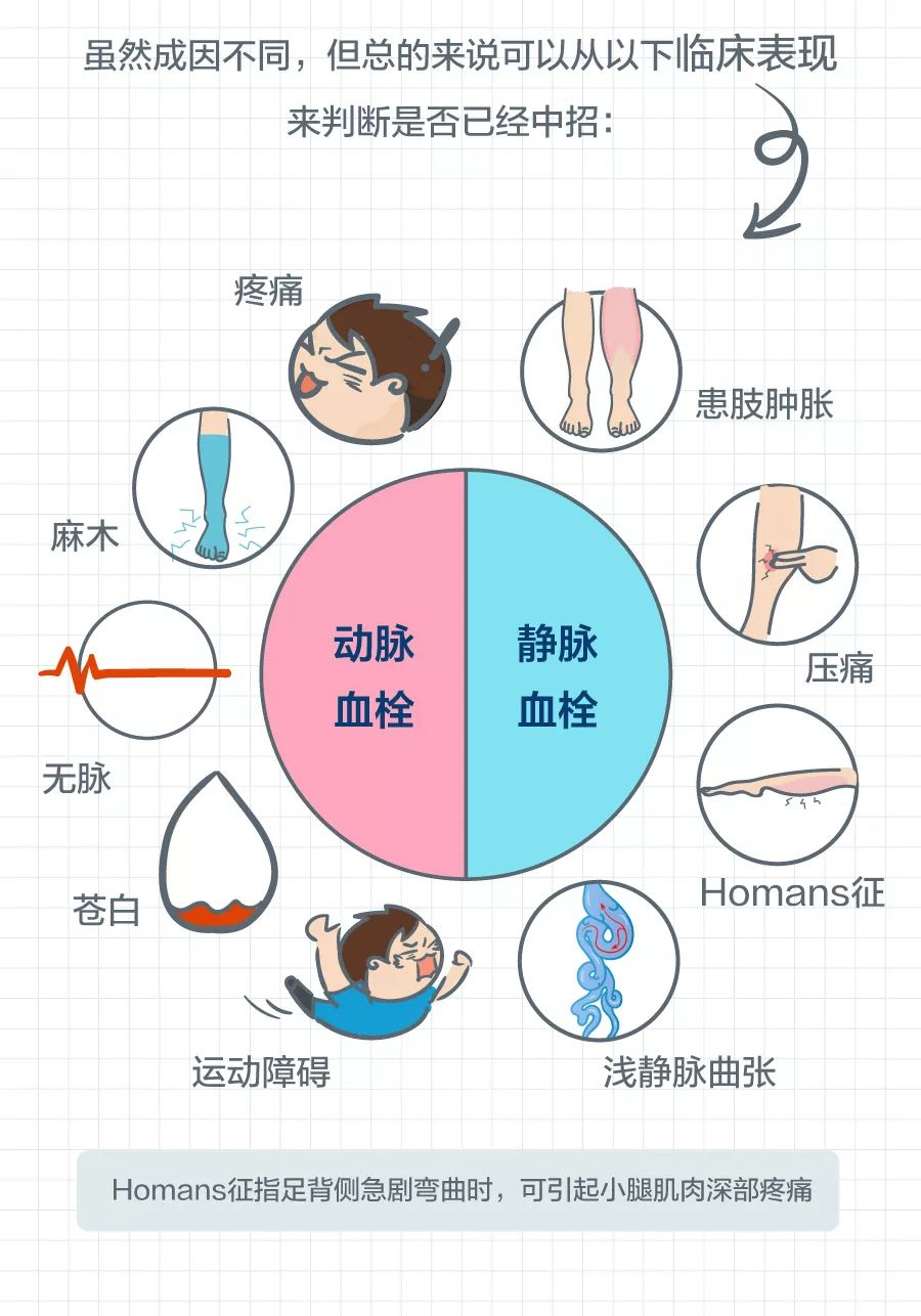 图文并茂帮你一次性搞懂动静脉血栓