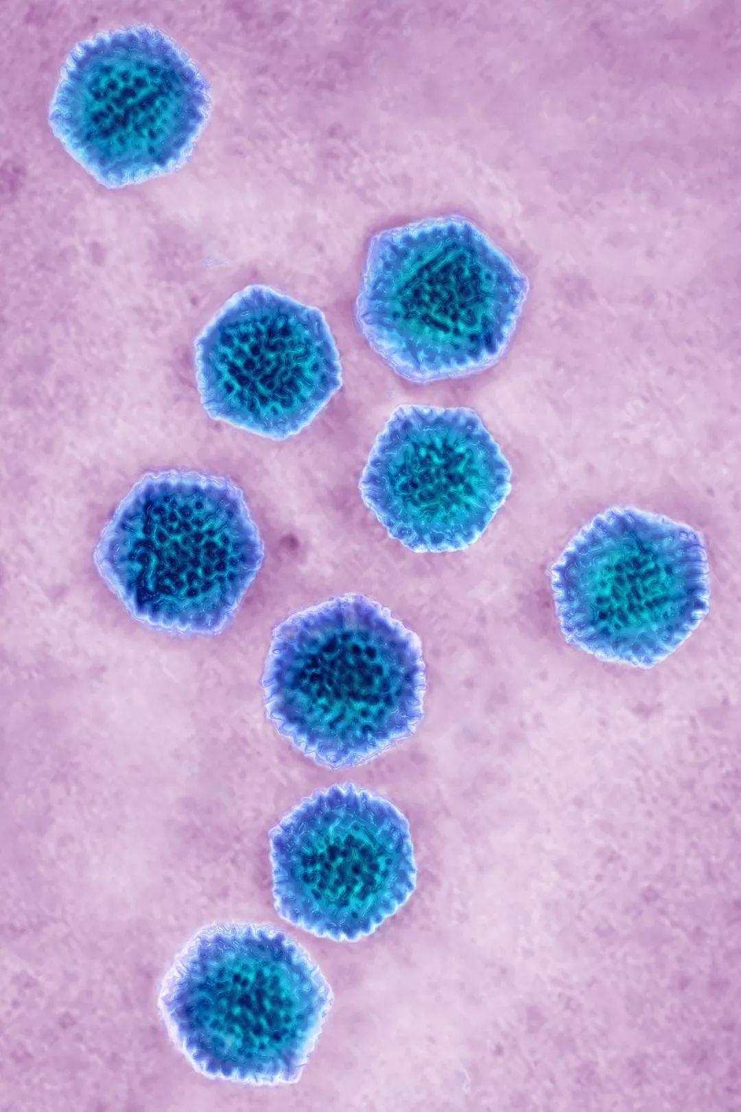 v2-aa52fc45e792404ec90cd7021cae703c_r.jpg
