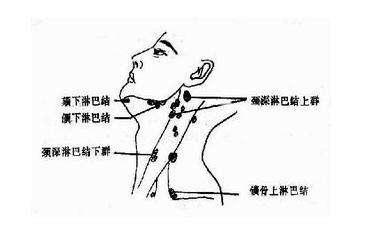 癌细胞可经胸导管上行,再经左颈干逆流至左锁骨上淋巴结